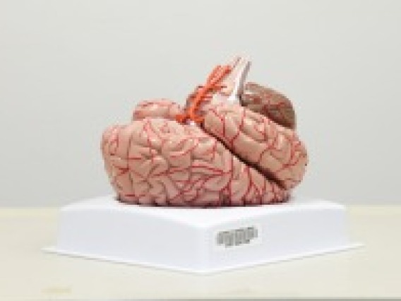 Axis Scientific 8-part deluxe human brain with arteries