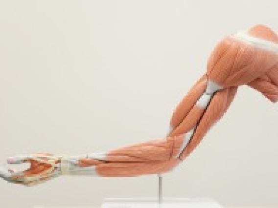 6-part deluxe muscle arm (life-size)
